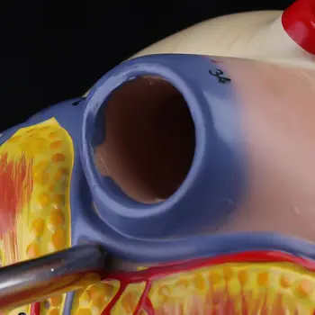 Разобранная Анатомическая Модель Человеческого Сердца Анатомия Медицинских Внутренних Органов Медицинский Десантный корабль