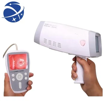 SY-F005 Цифровой Портативный кольпоскоп HD Видео Вагинальная камера для гинекологического обследования Цена